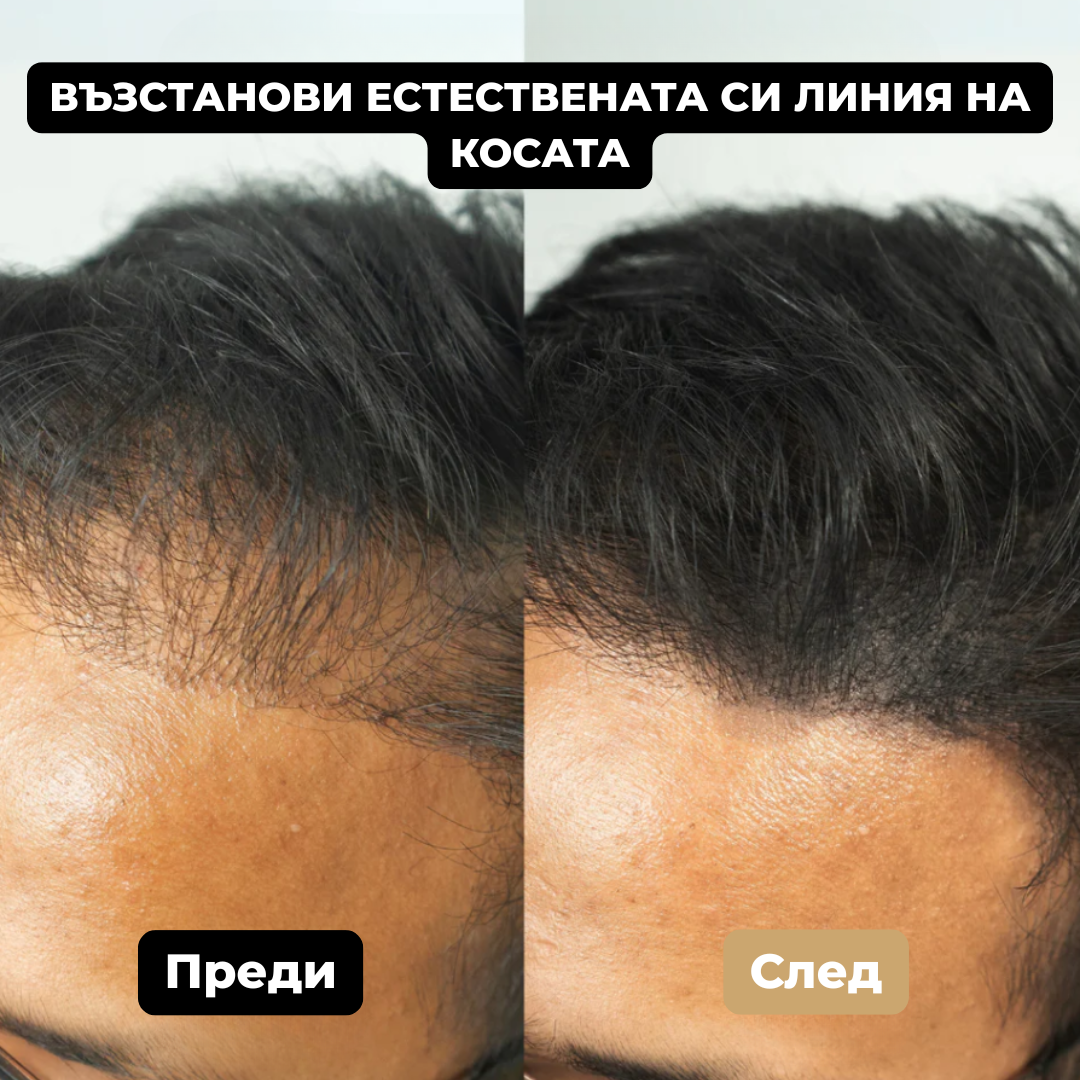 HairNova
